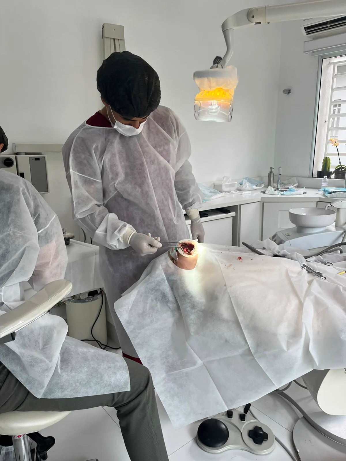 Procedimento de Gengivoplastia